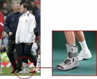 Top Tips on How to Manage an Ankle Sprain — figure 1