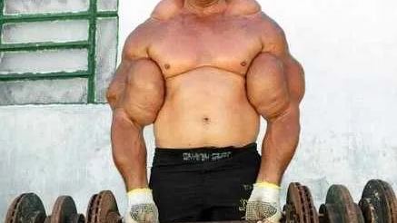Muscle Strain
