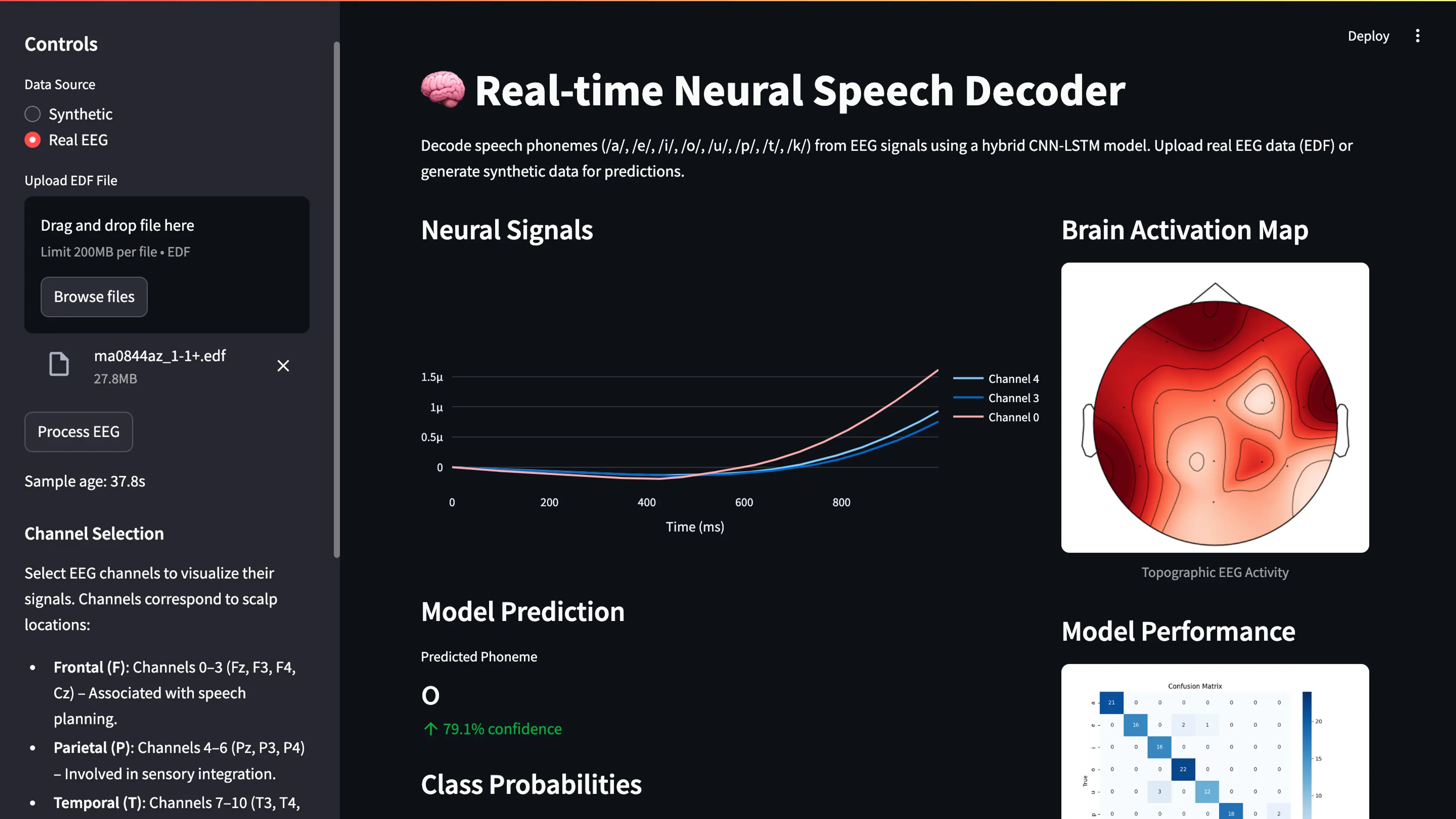 Brain - Computer Interface