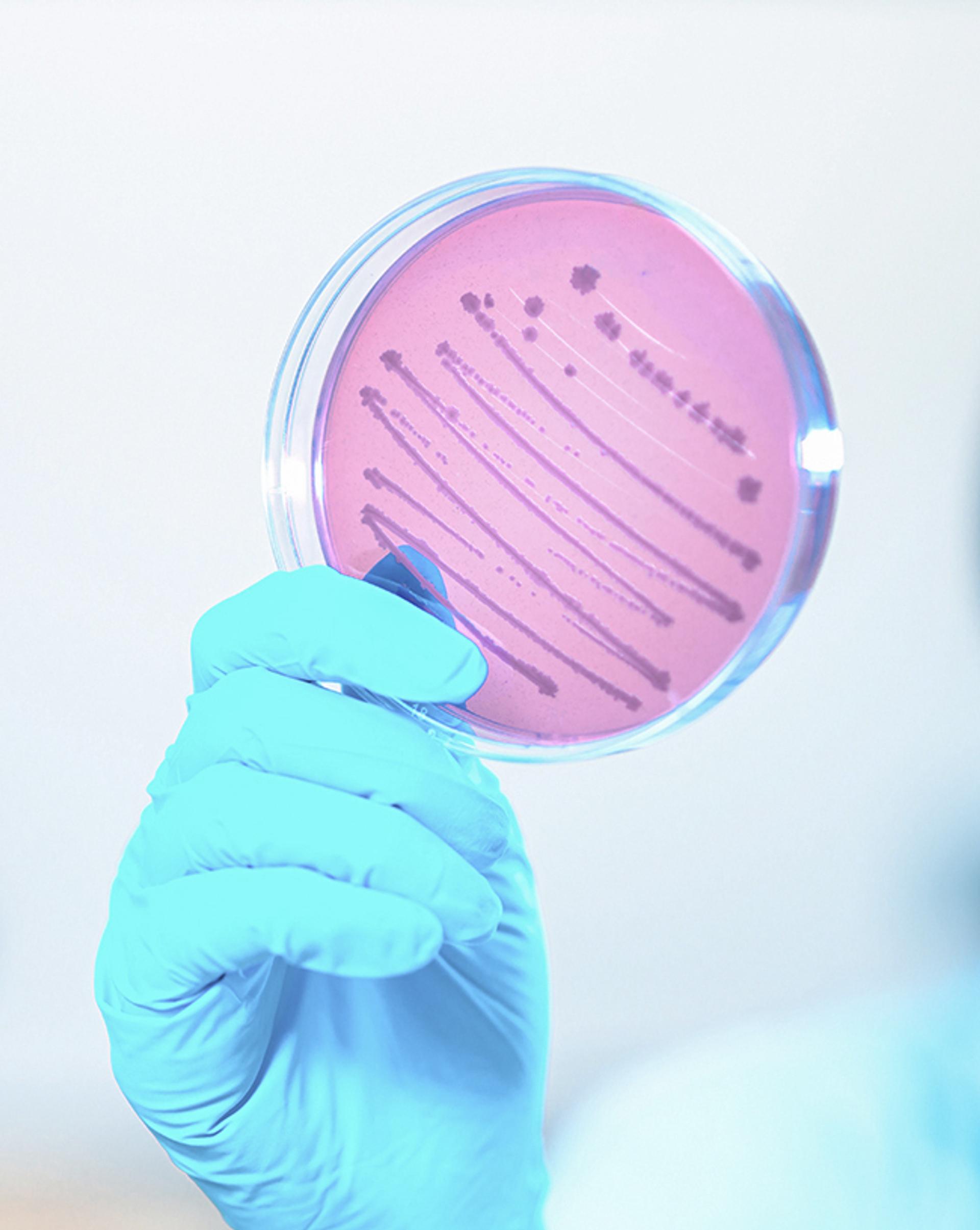 Gloved hand holding a petri dish with pink agar and visible bacterial culture streaks.