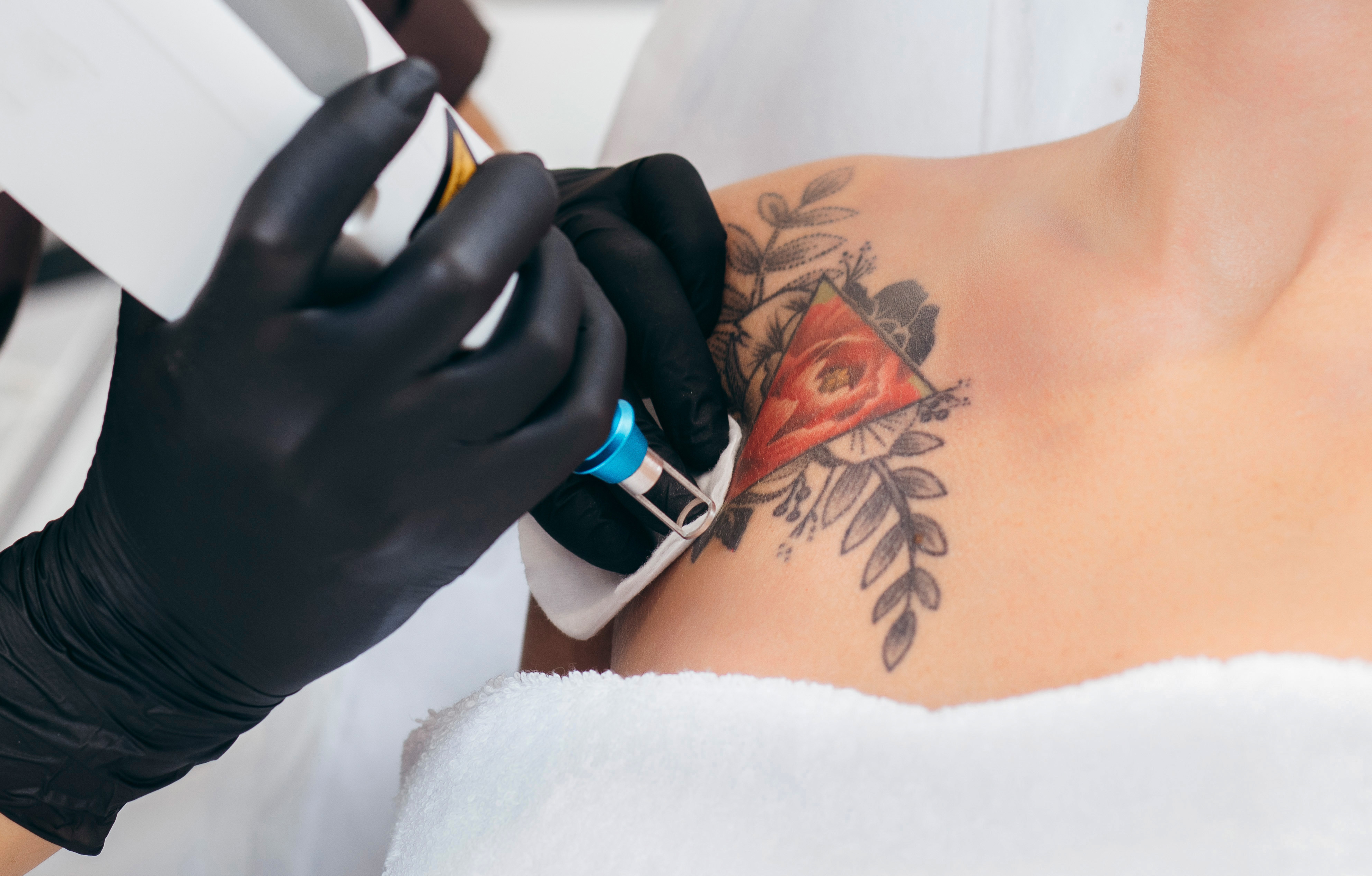 Tattoo removal: a colorful challenge requiring multiple laser wavelengths