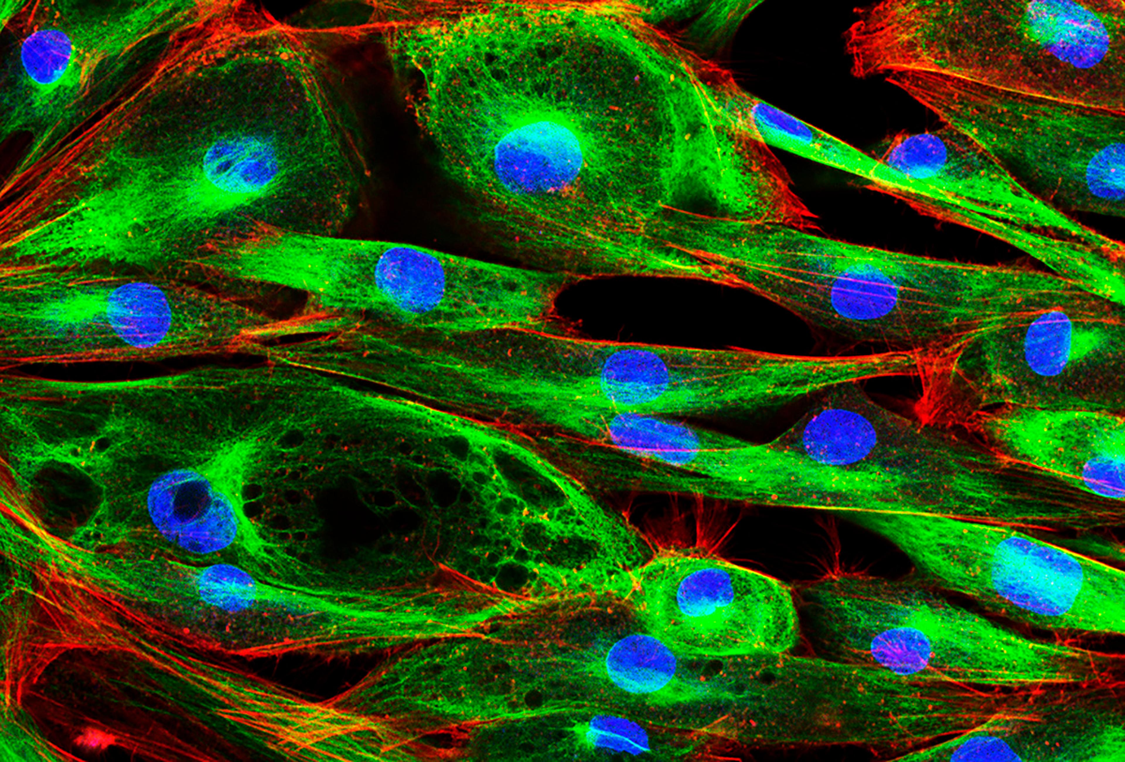 Confocal fluorescence microscopy image of fibroblast cells showing green cytoskeleton structures, red actin filaments, and blue-stained nuclei