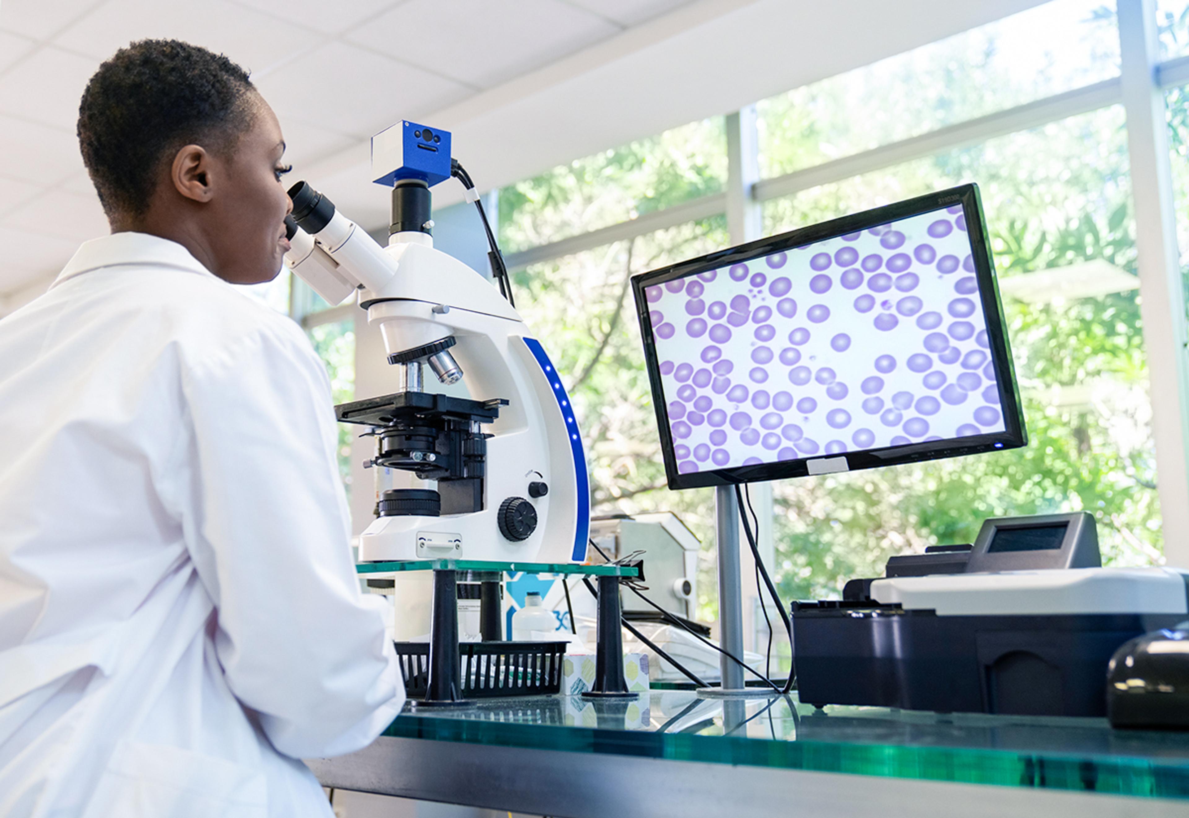 Laboratory scientist in a white coat uses a microscope connected to a monitor displaying magnified cells, in a bright lab with windows in the background.