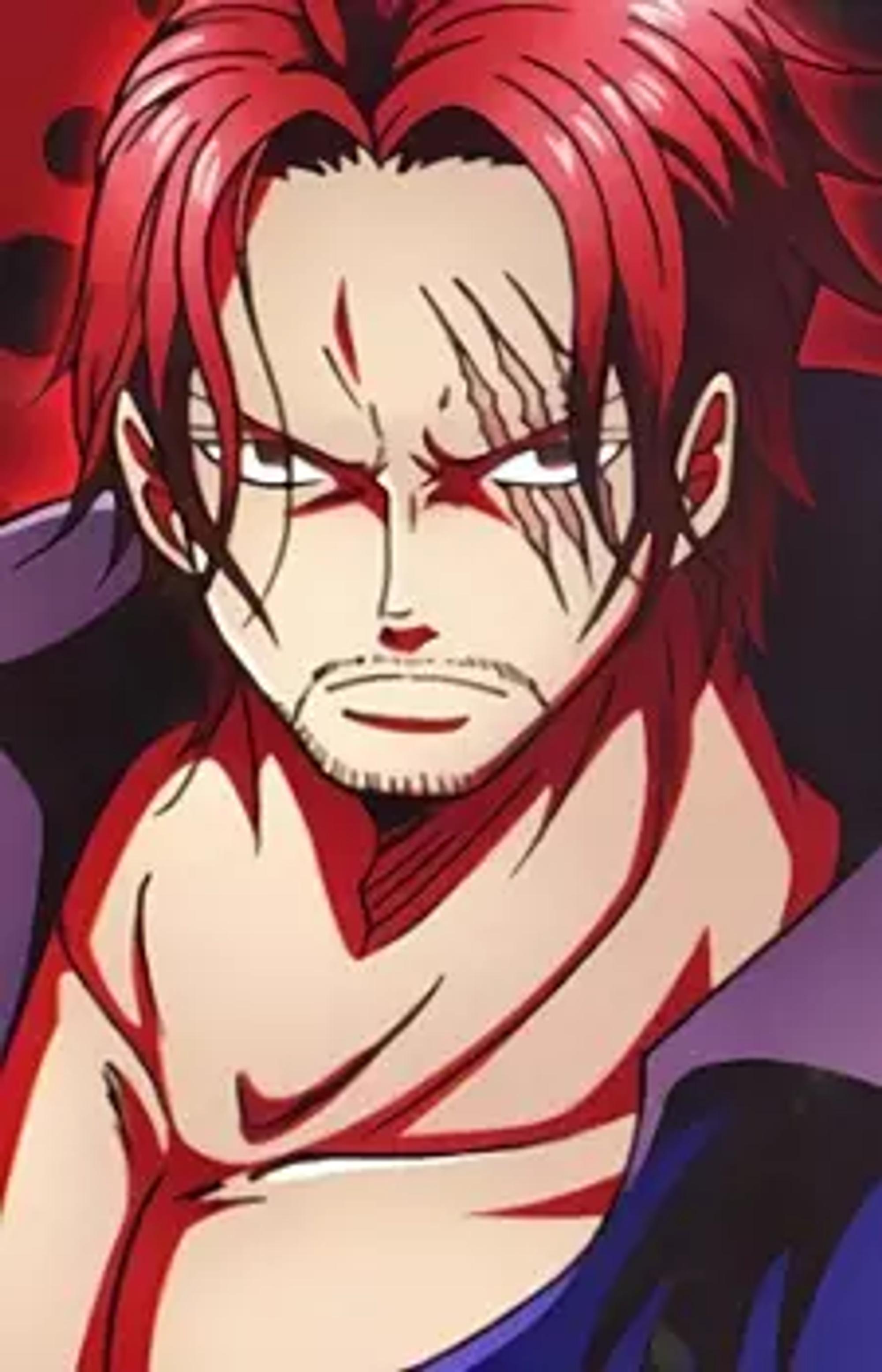 Shanks