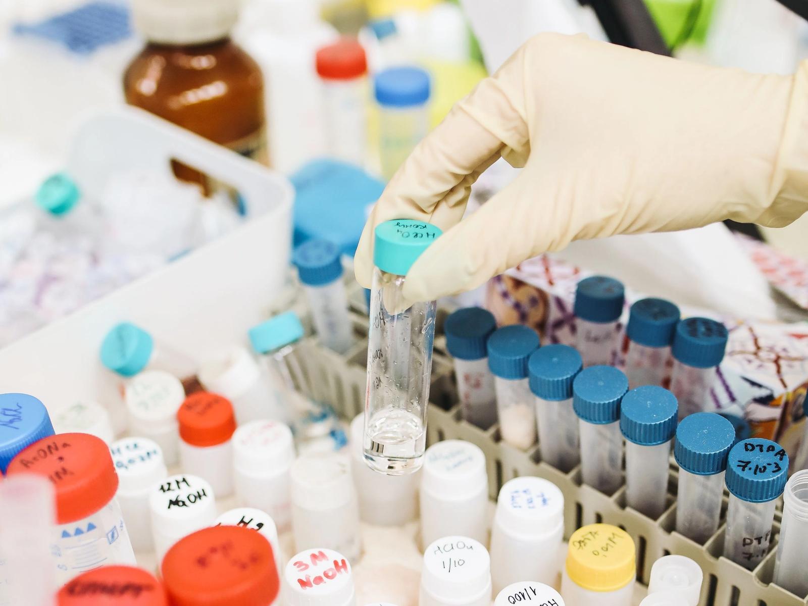 Gloved hands working with test tubes at a laboratory bench.