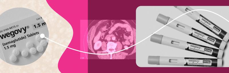 Wegovy for women: How it works, why results differ, and what women need to know