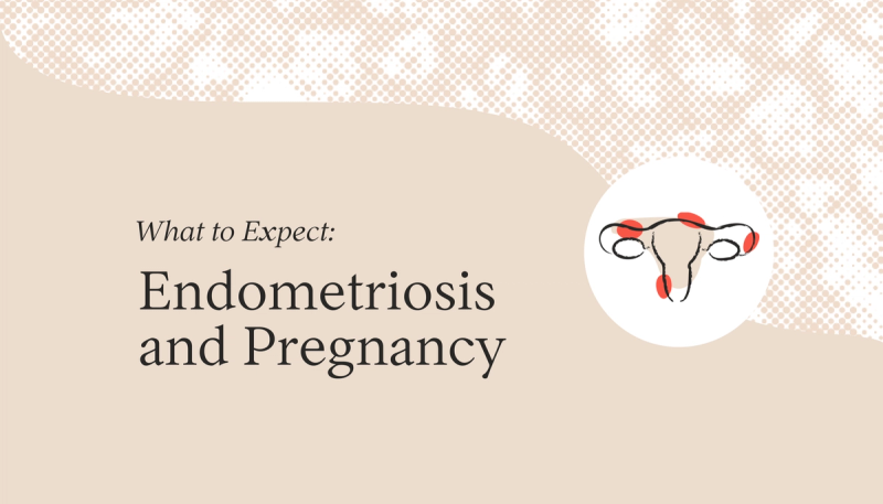 Endometriosis and Pregnancy: What to Expect
