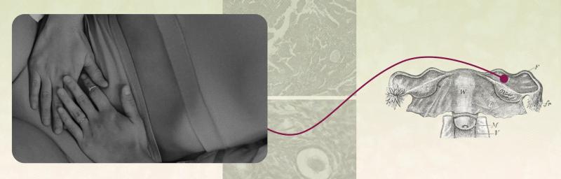 Endometriosis vs Endometrial Cancer: What You Should Know