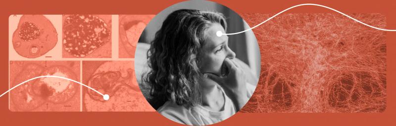 Zoloft for Women: Yes, Your Experience Is Different From Men's