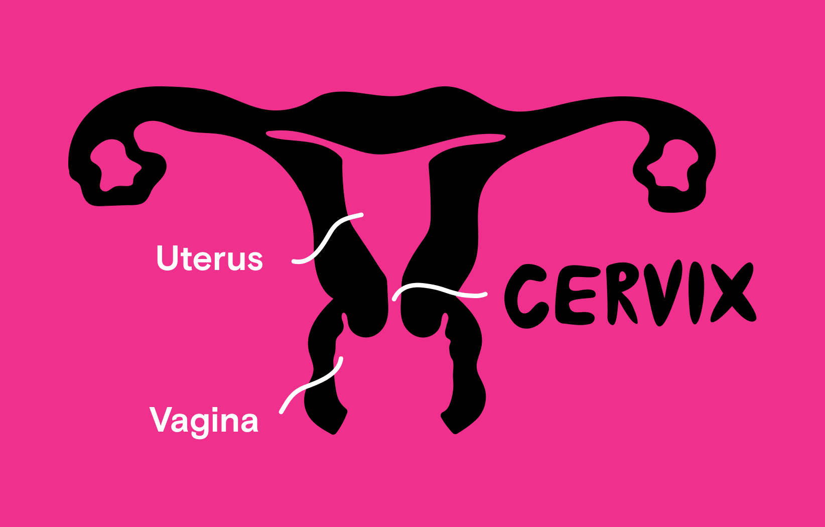 Cancel Cervical Cancer