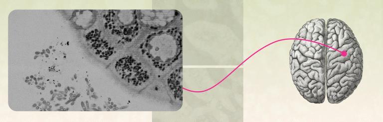 The ABCs of IBS in Women