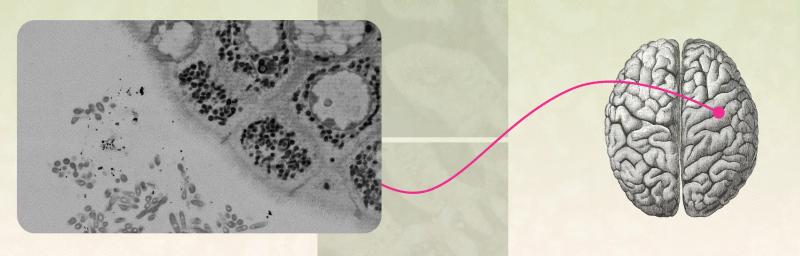 The ABCs of IBS in Women