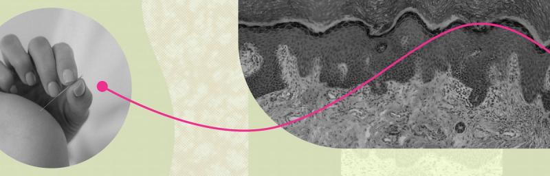 What is the interstitium, and what does it mean for acupuncture?
