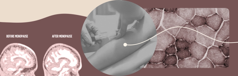 5 Things to Know About Hormone Testing for Perimenopause and Menopause