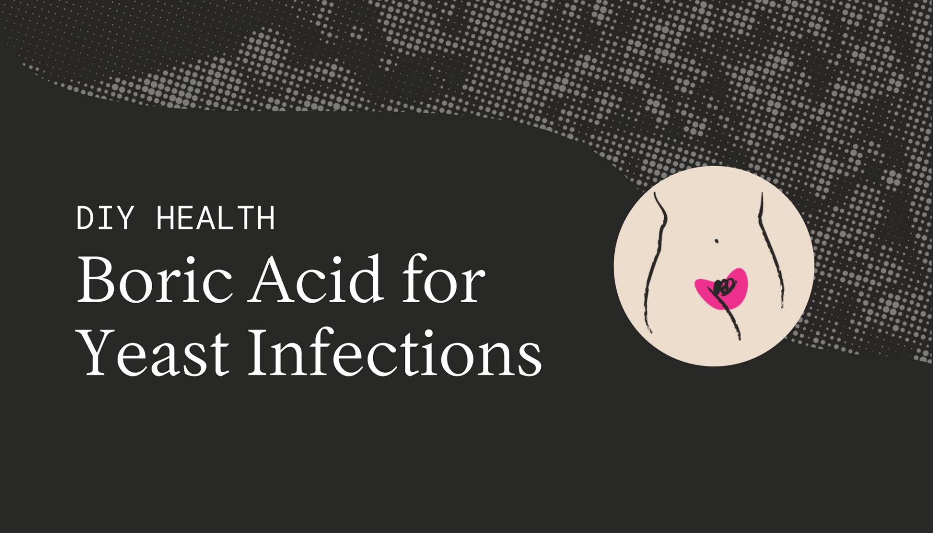 Can You Use Boric Acid to Treat a Vaginal Infection?