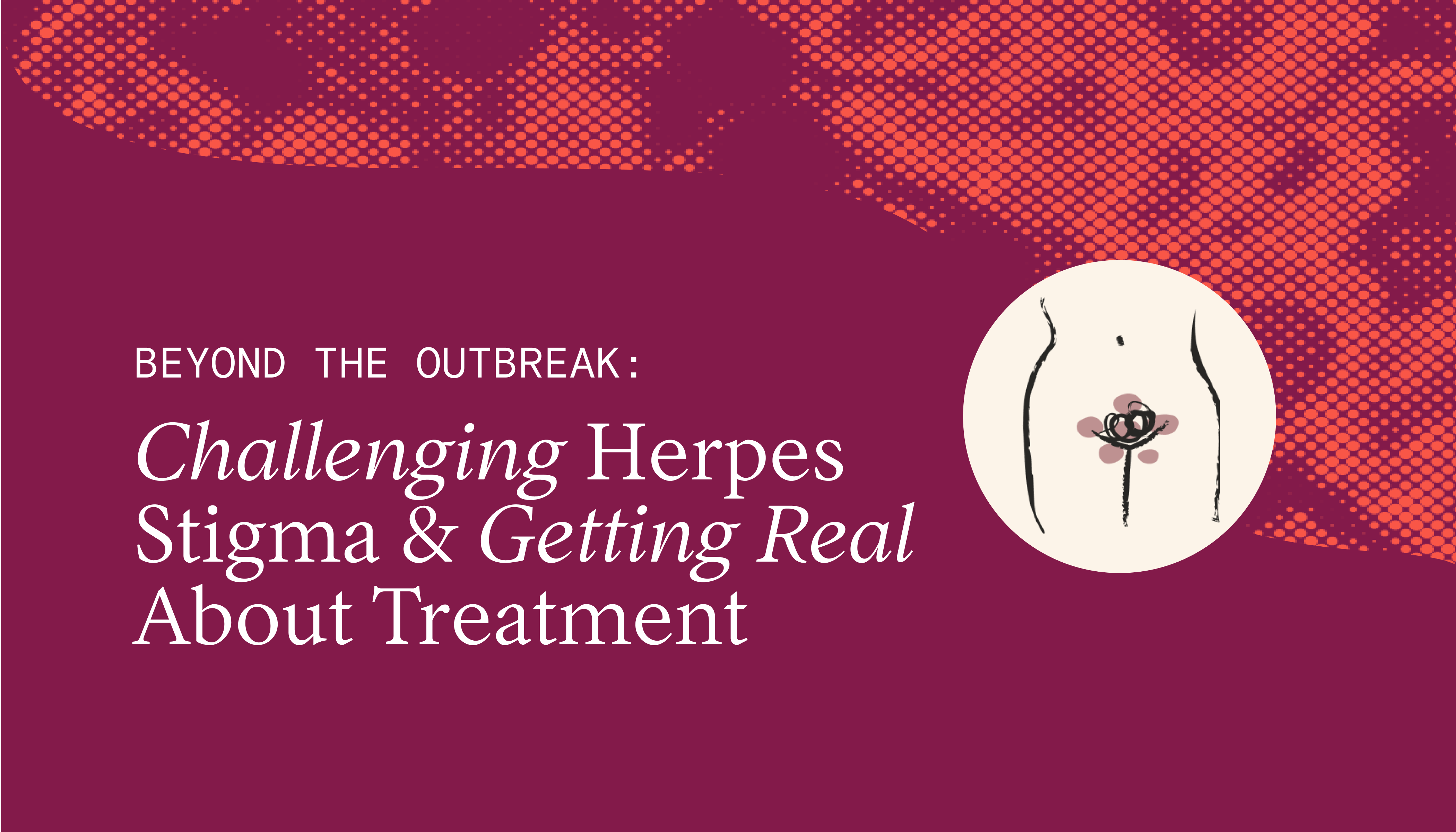 Herpes Outbreak After Metronidazole?  The Truth Revealed - t6cuygs