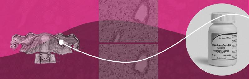 Progesterone: Prescriptions, supplements, and what women need to know