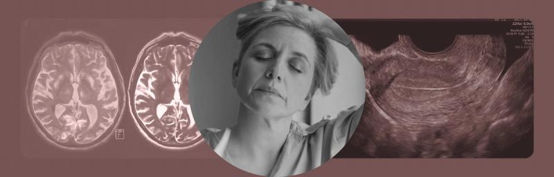 Unusual menopause symptoms that get mistaken for something else