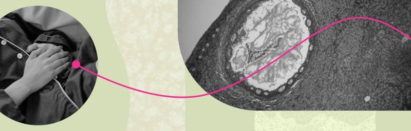 PCOS is now PMOS: more than just a name change