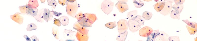 Abnormal Pap Results: What to do Next