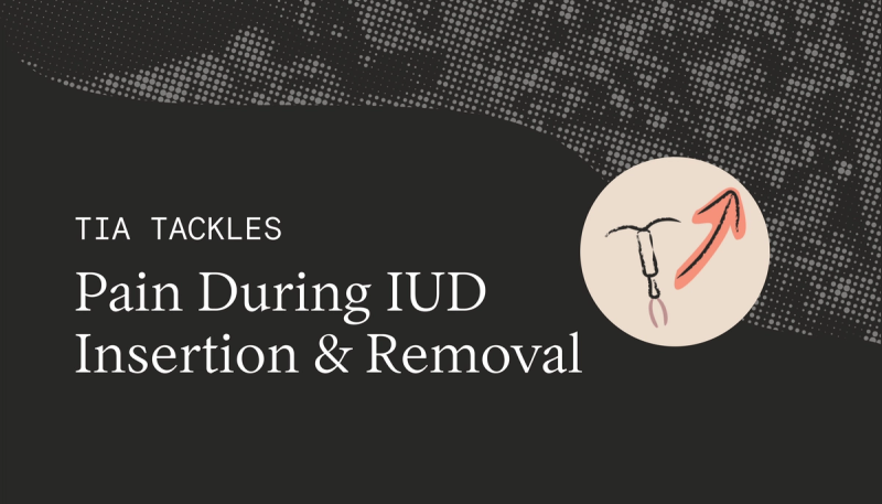 Managing Pain During IUD Insertion and Removal