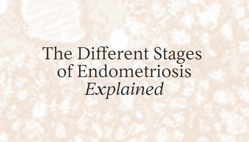 The Different Stages of Endometriosis Explained