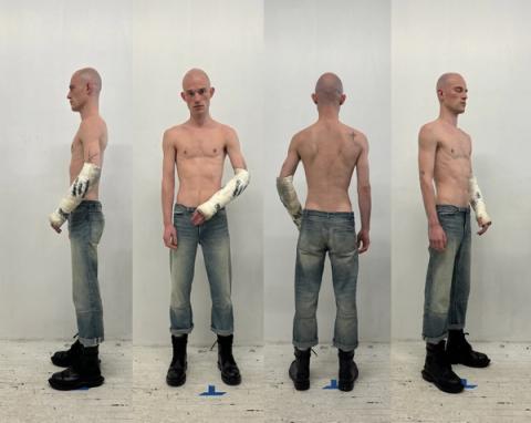 [Product Development][Distressed Arm Cast]