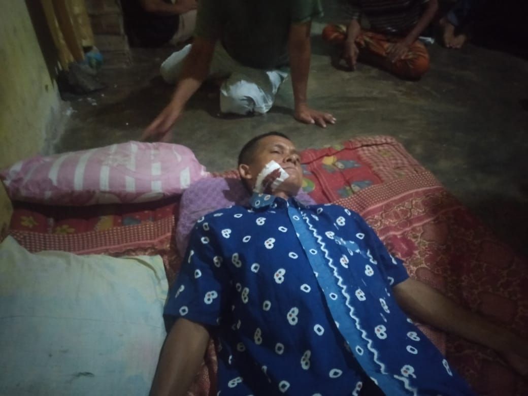 Memprihatinkan Lagi- Lagi Wartawan Di Aniaya