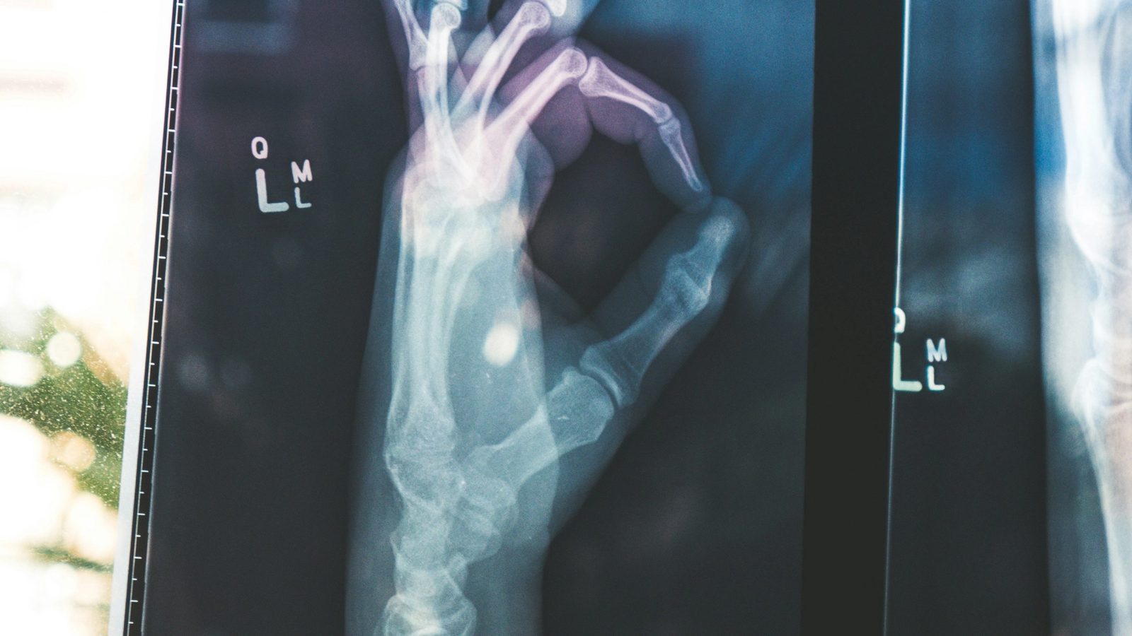 Main Image: X-ray, tech in Medicine
