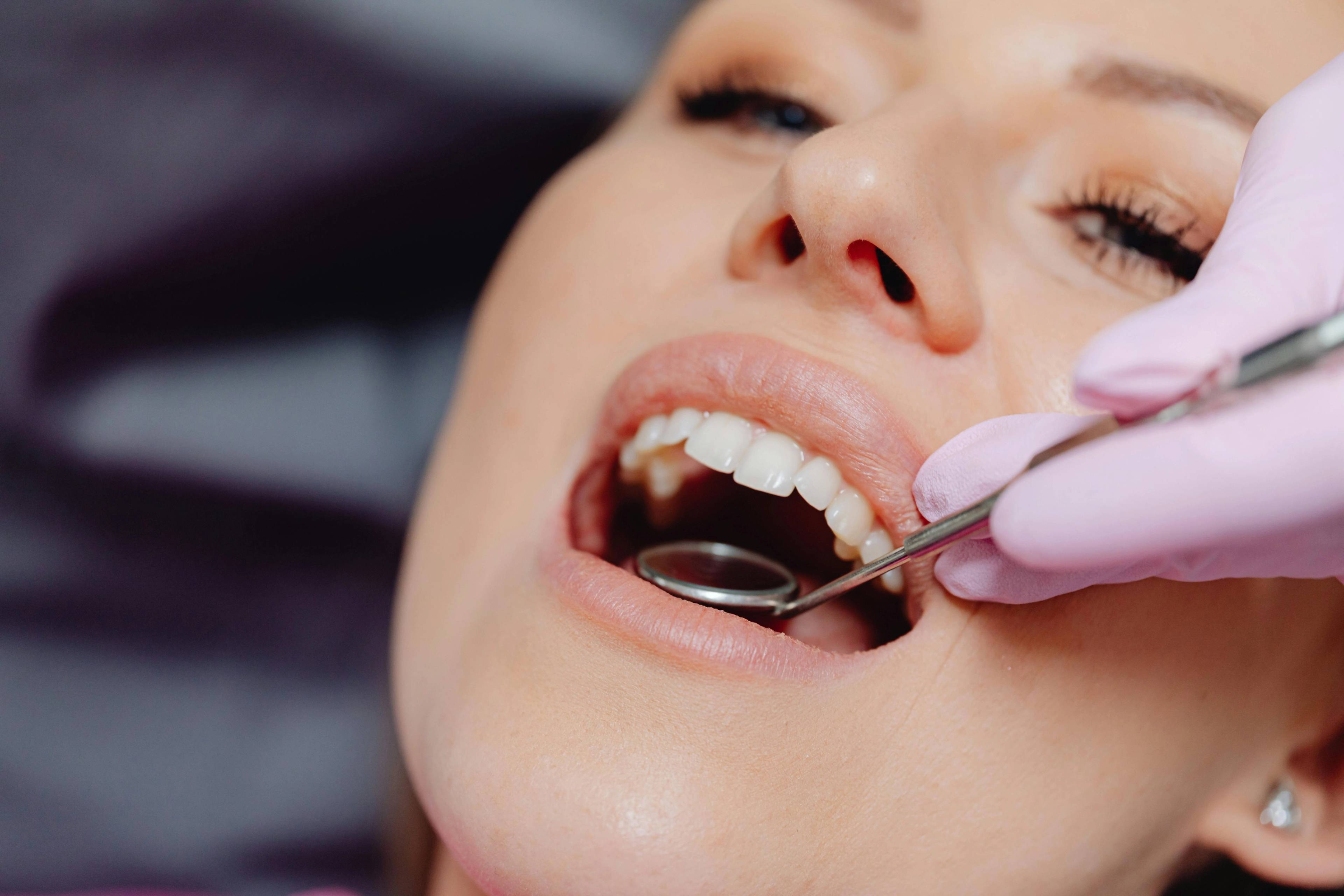 A stock photo of a woman having a dental exam