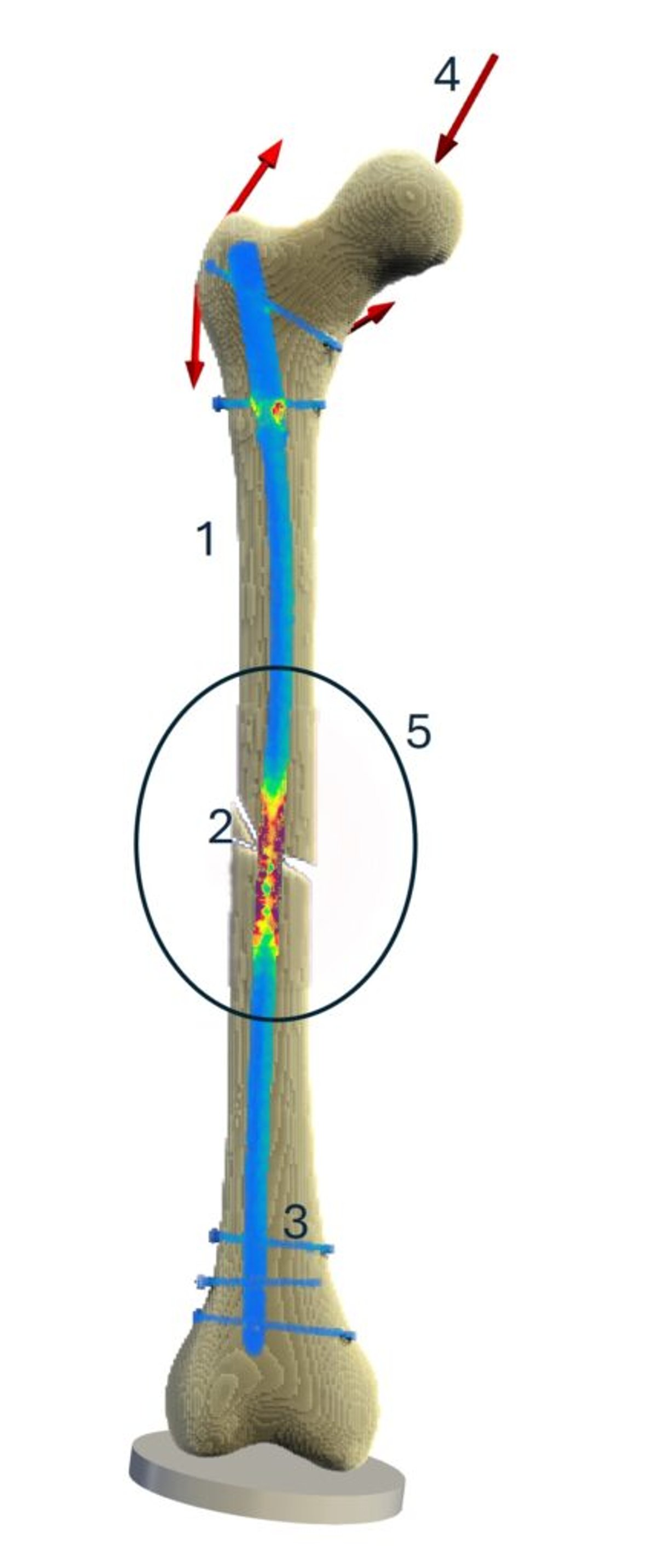 What is a digital twin for orthopedics and trauma surgery?​