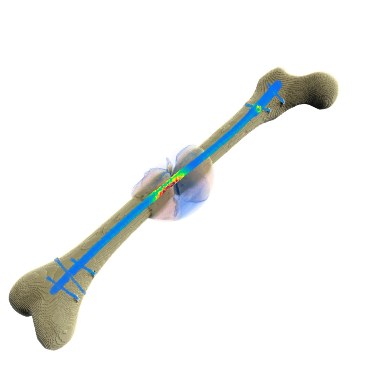 What is a digital twin for orthopedics and trauma surgery?​