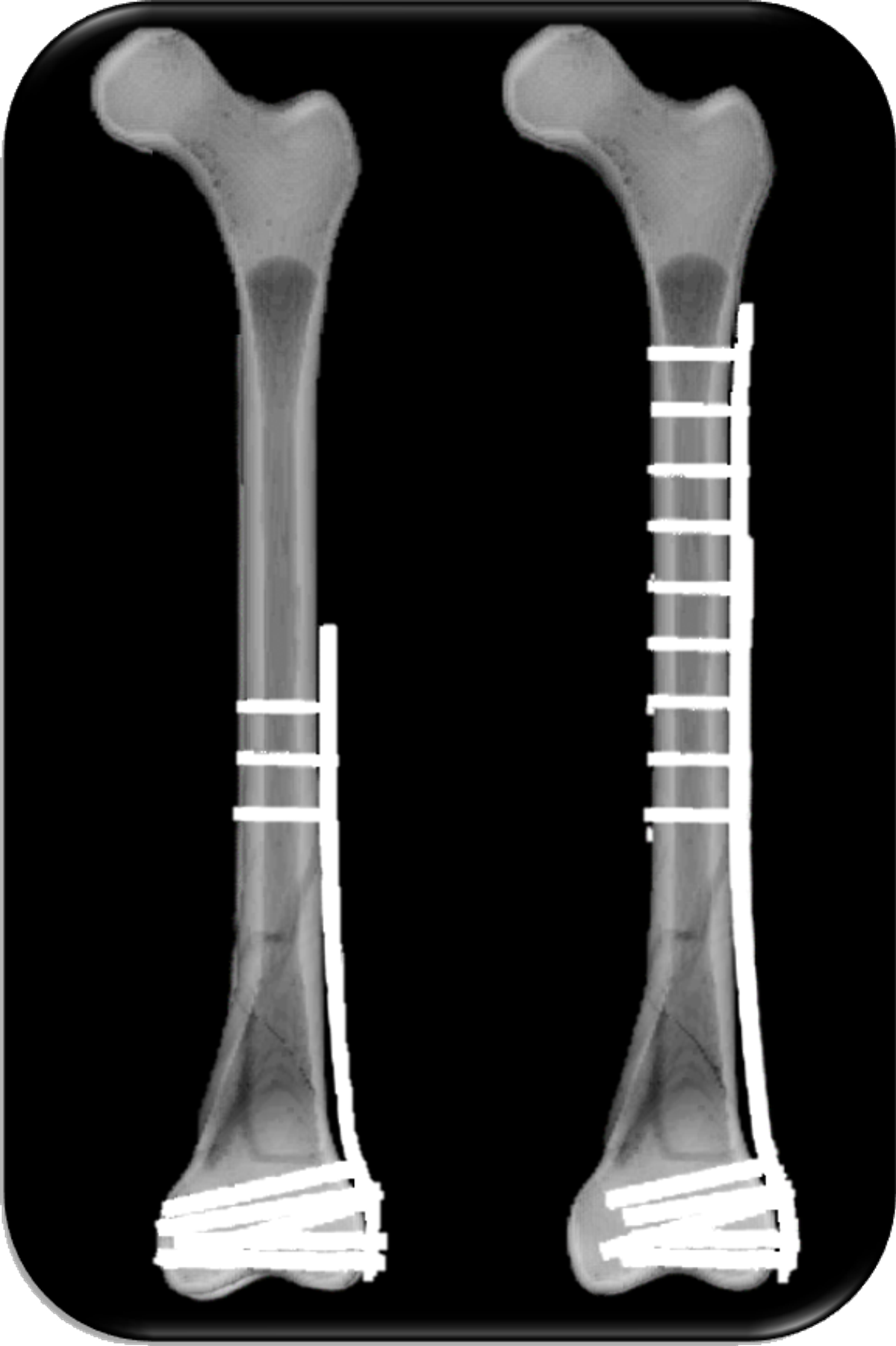 Take aways from AO TD Courses Case Discussion