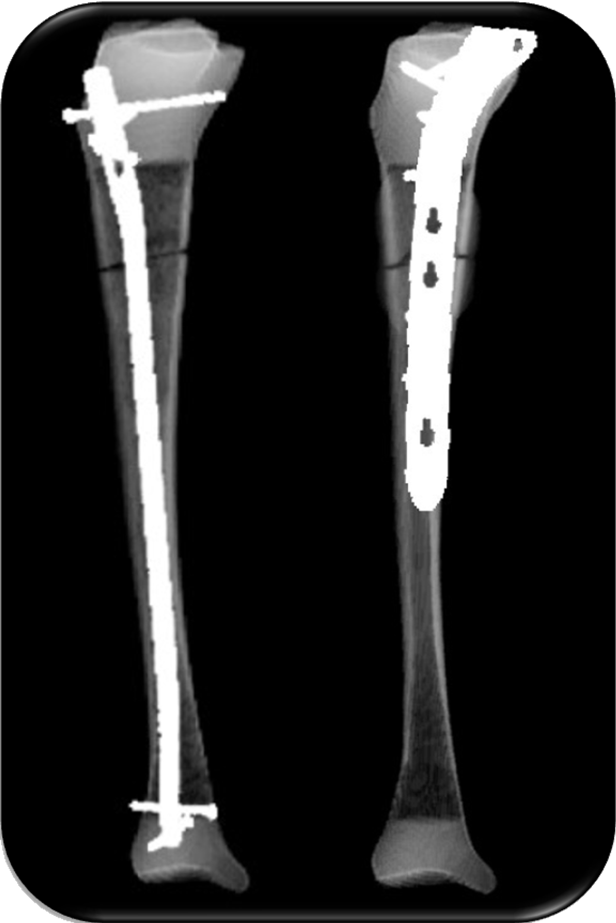 Take aways from AO TD Courses Case Discussion