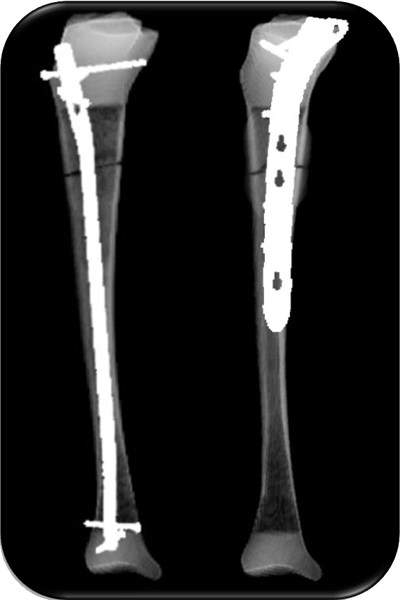 Take aways from AO TD Courses Case Discussion