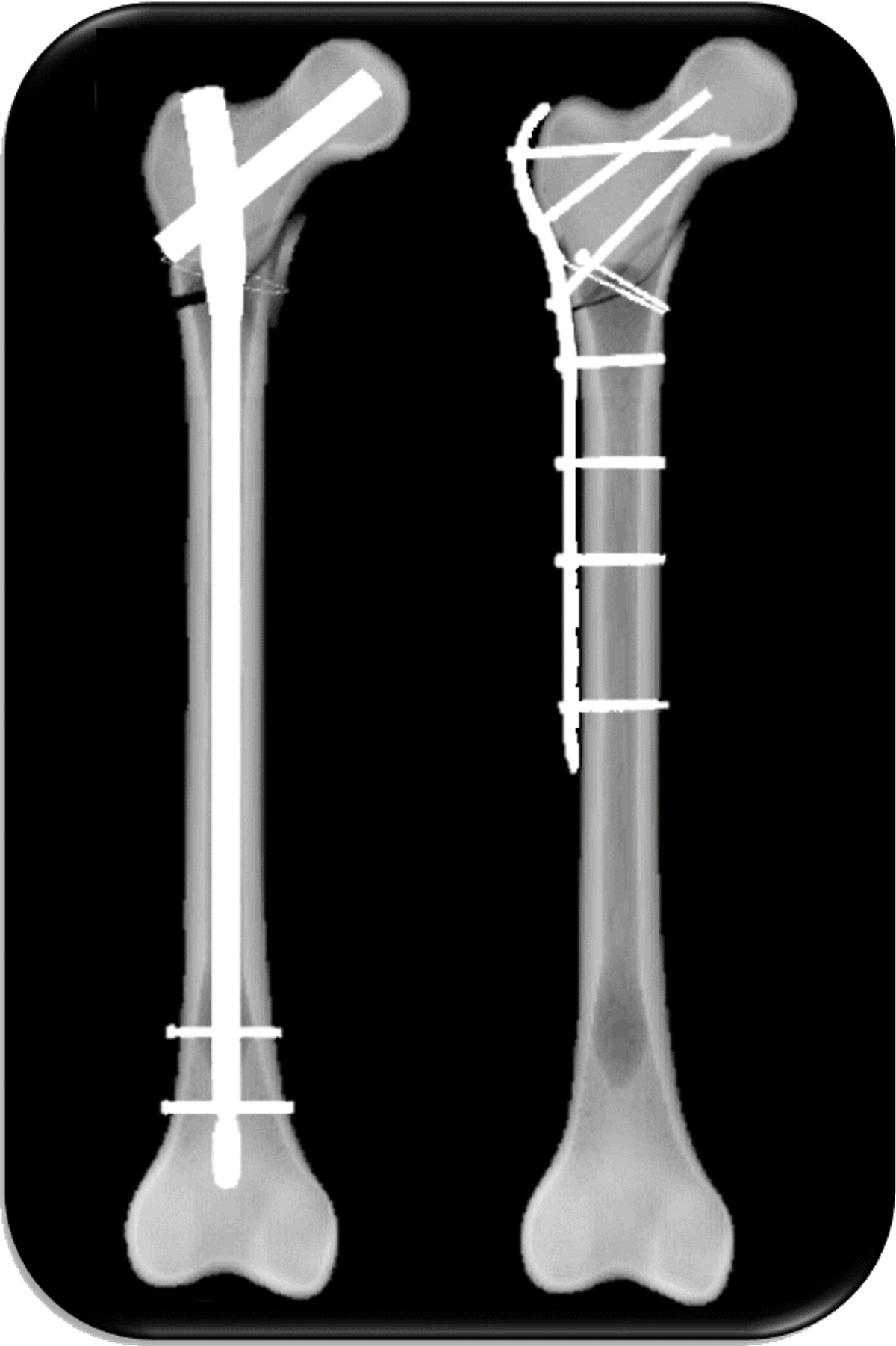 Take aways from AO TD Courses Case Discussion
