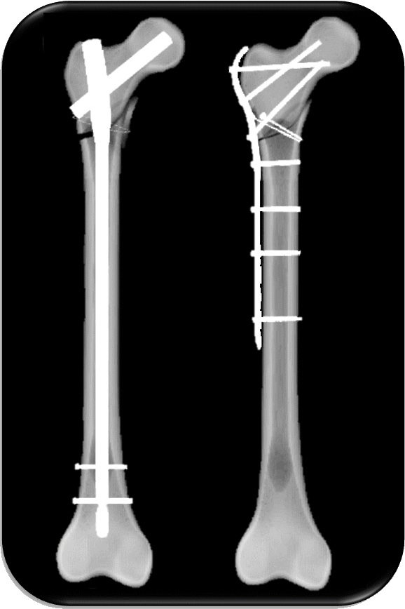 Take aways from AO TD Courses Case Discussion