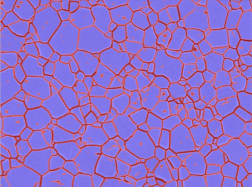 Clemex Studio for Metallography Applications: Grain Size​​​​‌﻿‍﻿​‍​‍‌‍﻿﻿‌﻿​‍‌‍‍‌‌‍‌﻿‌‍‍‌‌‍﻿‍​‍​‍​﻿‍‍​‍​‍‌﻿​﻿‌‍​‌‌‍﻿‍‌‍‍‌‌﻿‌​‌﻿‍‌​‍﻿‍‌‍‍‌‌‍﻿﻿​‍​‍​‍﻿​​‍​‍‌‍‍​‌﻿​‍‌‍‌‌‌‍‌‍​‍​‍​﻿‍‍​‍​‍‌‍‍​‌﻿‌​‌﻿‌​‌﻿​​‌﻿​﻿​﻿‍‍​‍﻿﻿​‍﻿﻿‌‍​﻿‌‍﻿​‌‍‌‌‌‍﻿‌‌‍‌‌‌﻿‍​​‍﻿‌‌﻿​﻿‌﻿‌​‌﻿‌‌‌‍‌​‌‍‍‌‌‍﻿﻿​‍﻿‍‌﻿‌‍‌‍‌‌‌﻿​‍‌‍​﻿‌‍‌‌‌‍﻿​​‍﻿‍‌‍​‌‌﻿​​‌﻿​​​‍﻿﻿‌‍‍‌‌‍﻿‍‌﻿‌​‌‍‌‌‌‍﻿‍‌﻿‌​​‍﻿﻿‌‍‌‌‌‍‌​‌‍‍‌‌﻿‌​​‍﻿﻿‌‍﻿‌‌‍﻿﻿‌‍‌​‌‍‌‌​﻿﻿‌‌﻿​​‌﻿​‍‌‍‌‌‌﻿​﻿‌‍‌‌‌‍﻿‍‌﻿‌​‌‍​‌‌﻿‌​‌‍‍‌‌‍﻿﻿‌‍﻿‍​﻿‍﻿‌‍‍‌‌‍‌​​﻿﻿‌​﻿‌﻿​﻿​‍‌‍‌‍​﻿‍​​﻿‌​​﻿​‍​﻿‌‌​﻿​﻿​‍﻿‌​﻿‍‌​﻿‌‍​﻿​​​﻿‌‌​‍﻿‌​﻿‌​​﻿​‌​﻿‌​​﻿‍‌​‍﻿‌‌‍​‍‌‍​‍​﻿​‍‌‍‌‍​‍﻿‌​﻿​‌‌‍​﻿​﻿​‍​﻿​‌‌‍​﻿​﻿​​‌‍​‌​﻿‌​​﻿‌﻿‌‍‌‍​﻿‌‌​﻿‍‌​﻿‍﻿‌﻿‌​‌﻿‍‌‌﻿​​‌‍‌‌​﻿﻿‌‌‍​‍‌‍﻿​‌‍﻿﻿‌‍‌﻿​﻿‍﻿‌﻿​​‌‍​‌‌﻿‌​‌‍‍​​﻿﻿‌‌﻿‌​‌‍‍‌‌﻿‌​‌‍﻿​‌‍‌‌​﻿﻿﻿‌‍​‍‌‍​‌‌﻿​﻿‌‍‌‌‌‌‌‌‌﻿​‍‌‍﻿​​﻿﻿‌‌‍‍​‌﻿‌​‌﻿‌​‌﻿​​‌﻿​﻿​‍‌‌​﻿​﻿‌​​‌​‍‌‌​﻿​‍‌​‌‍​‍‌‌​﻿​‍‌​‌‍‌‍​﻿‌‍﻿​‌‍‌‌‌‍﻿‌‌‍‌‌‌﻿‍​​‍﻿‌‌﻿​﻿‌﻿‌​‌﻿‌‌‌‍‌​‌‍‍‌‌‍﻿﻿​‍﻿‍‌﻿‌‍‌‍‌‌‌﻿​‍‌‍​﻿‌‍‌‌‌‍﻿​​‍﻿‍‌‍​‌‌﻿​​‌﻿​​​‍‌‍‌‍‍‌‌‍‌​​﻿﻿‌​﻿‌﻿​﻿​‍‌‍‌‍​﻿‍​​﻿‌​​﻿​‍​﻿‌‌​﻿​﻿​‍﻿‌​﻿‍‌​﻿‌‍​﻿​​​﻿‌‌​‍﻿‌​﻿‌​​﻿​‌​﻿‌​​﻿‍‌​‍﻿‌‌‍​‍‌‍​‍​﻿​‍‌‍‌‍​‍﻿‌​﻿​‌‌‍​﻿​﻿​‍​﻿​‌‌‍​﻿​﻿​​‌‍​‌​﻿‌​​﻿‌﻿‌‍‌‍​﻿‌‌​﻿‍‌​‍‌‍‌﻿‌​‌﻿‍‌‌﻿​​‌‍‌‌​﻿﻿‌‌‍​‍‌‍﻿​‌‍﻿﻿‌‍‌﻿​‍‌‍‌﻿​​‌‍​‌‌﻿‌​‌‍‍​​﻿﻿‌‌﻿‌​‌‍‍‌‌﻿‌​‌‍﻿​‌‍‌‌​‍‌‍‌﻿​​‌‍‌‌‌﻿​‍‌﻿​﻿‌﻿​​‌‍‌‌‌‍​﻿‌﻿‌​‌‍‍‌‌﻿‌‍‌‍‌‌​﻿﻿‌‌﻿​​‌﻿‌‌‌‍​‍‌‍﻿​‌‍‍‌‌﻿​﻿‌‍‍​‌‍‌‌‌‍‌​​‍​‍‌﻿﻿‌