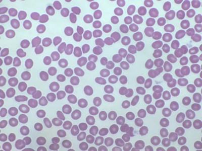 Blood cells