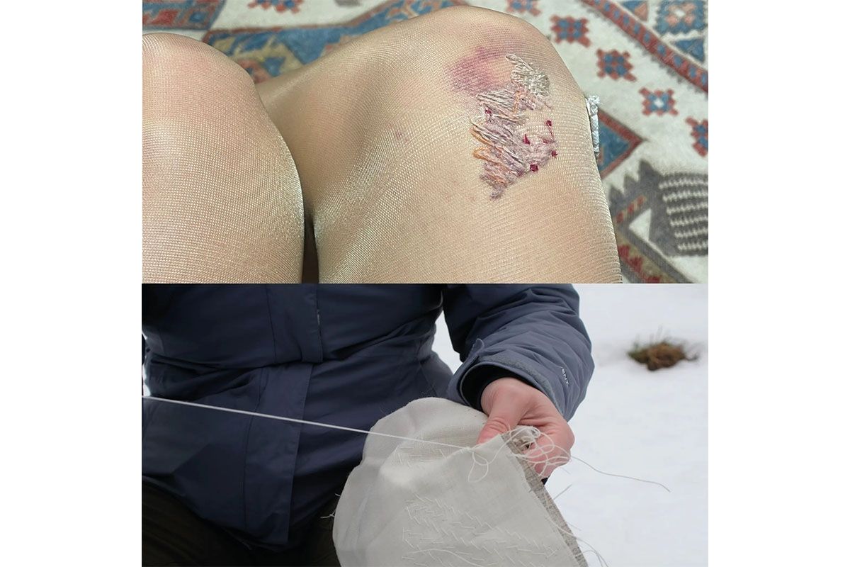 Photo montage of stockings with thread repair on knee and person stitching on fabric