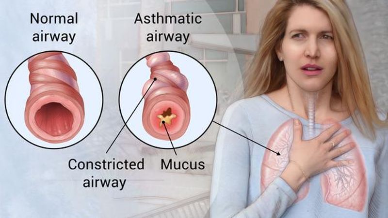 asthma