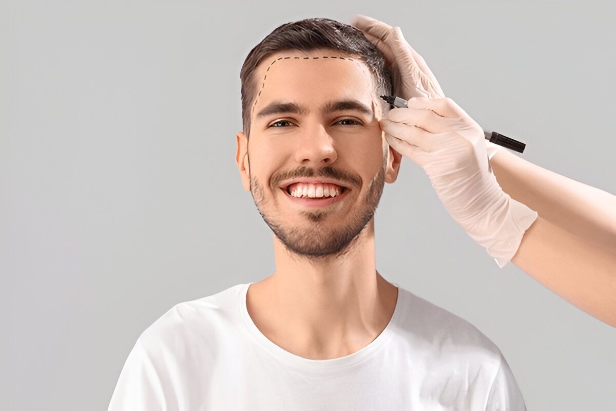 hair transplant in younger age hair transplant in younger age