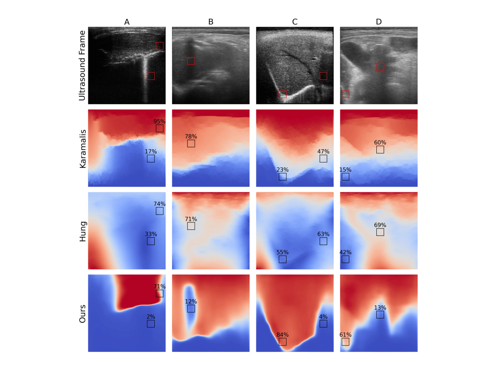 A 4x4 matrix of ultrasound frames comparing US confidence maps