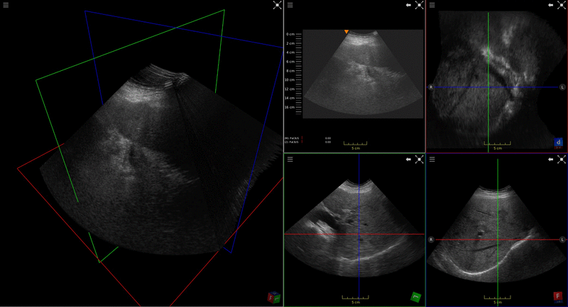 live sweep recording and compounding in real time