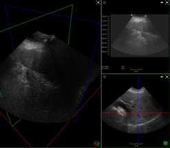 live sweep recording and compounding in real time