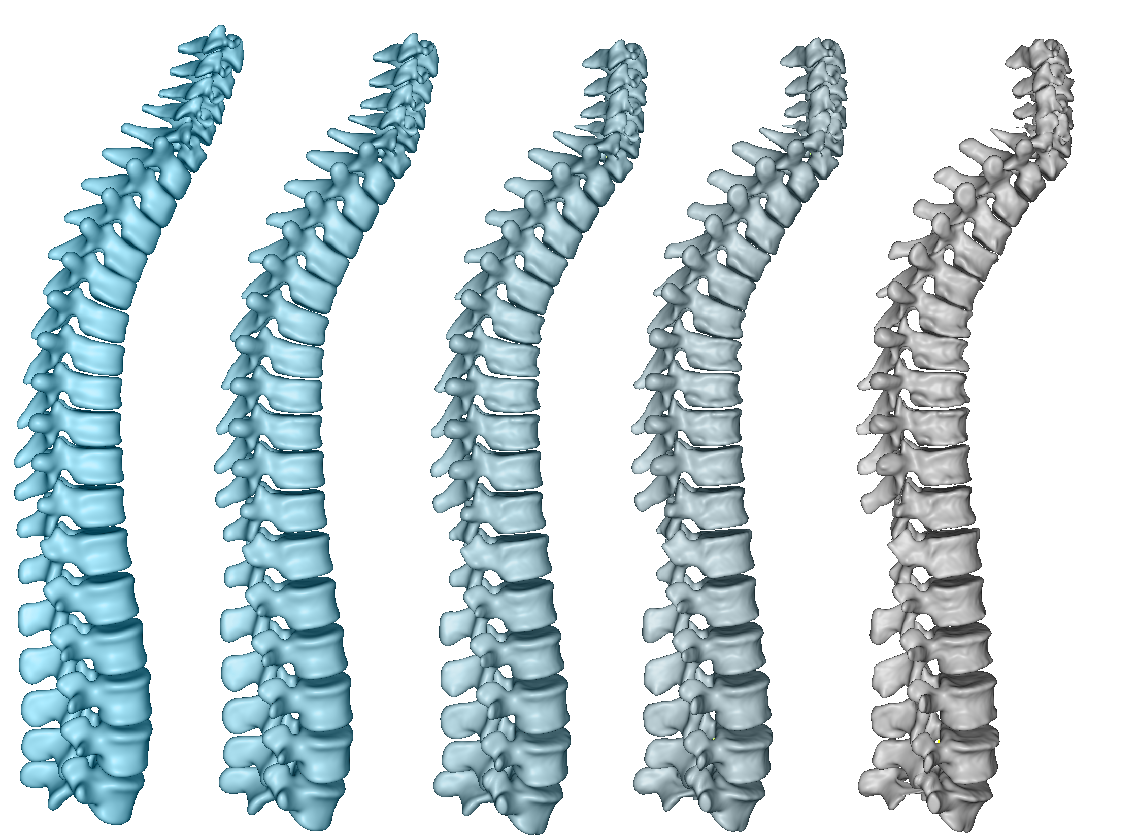 Deformable spine-to-spine registration