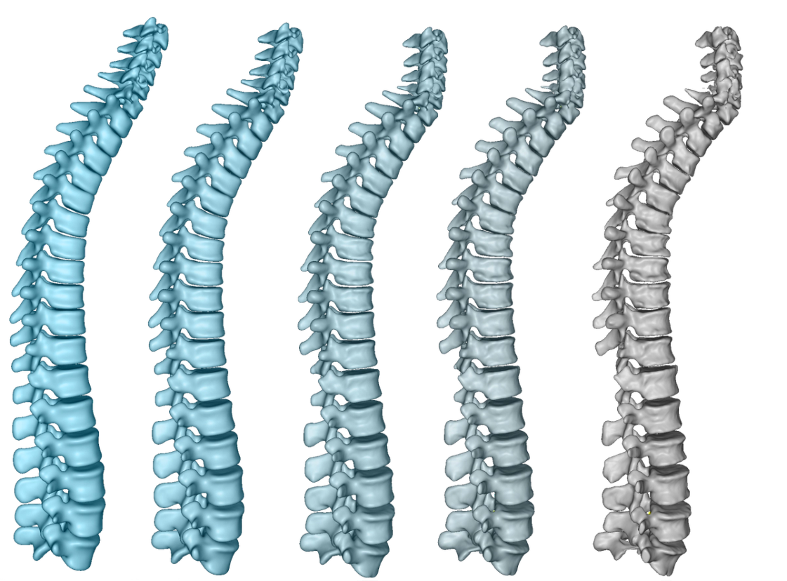 Gradient 3D spine reconstruction used in the Spine Suite demo