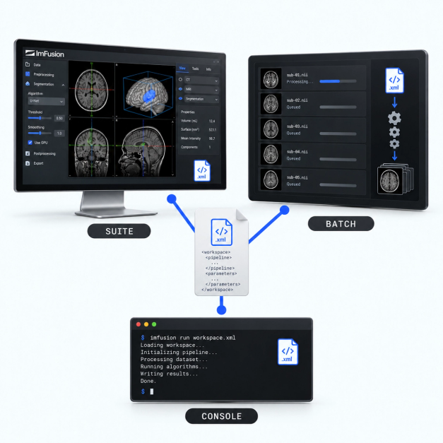 Suite algorithms
