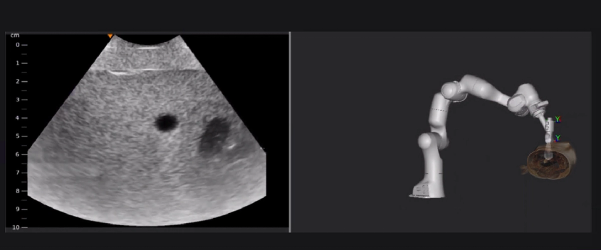 Robotic ultrasound scanning with ImFusion Suite