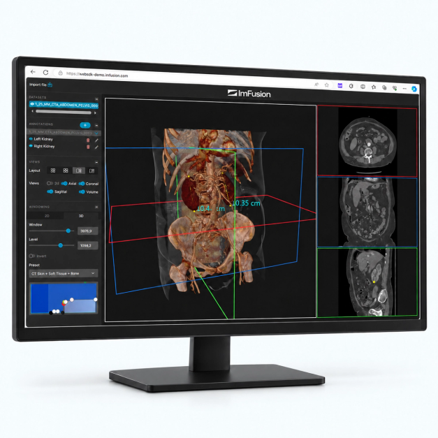 WebSDK, medical imaging javascript and typescript library for viewing and reading DICOM data in the browser